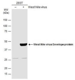 West Nile Virus Envelope Antibody, Novus Biologicals 100 &mu;g | Buy Online | Novus Biologicals | Fisher Scientific